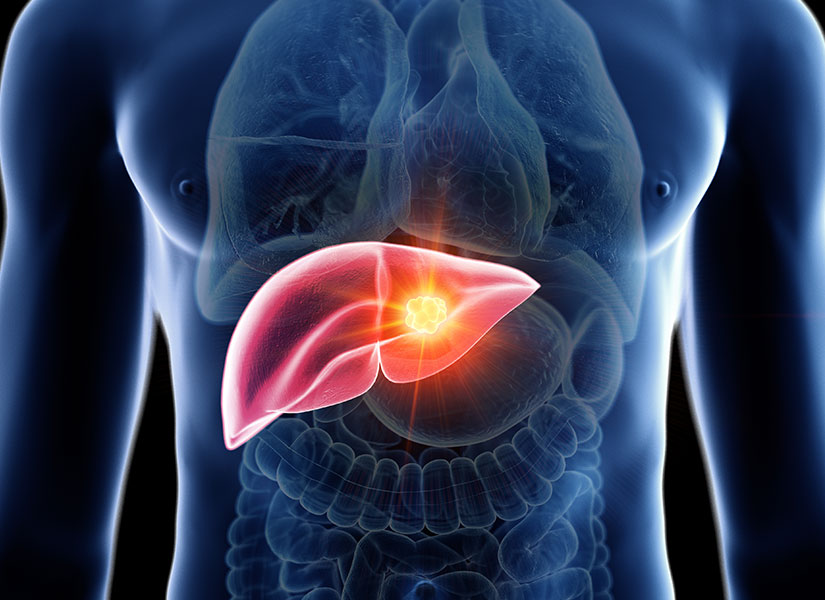 Hepatitis B