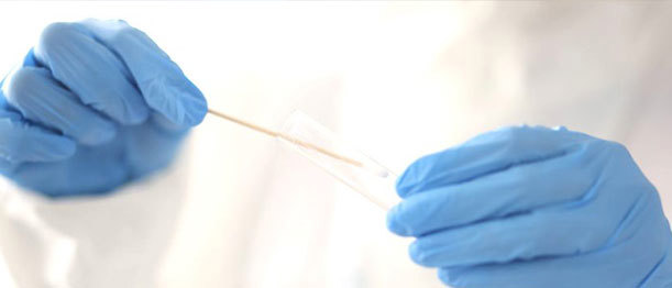 Detection of New SARS-COVID19 Variants on PCR Testing