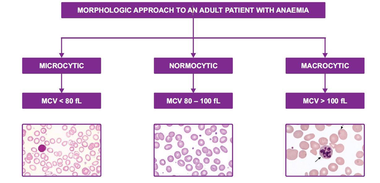 Anaemia Fig