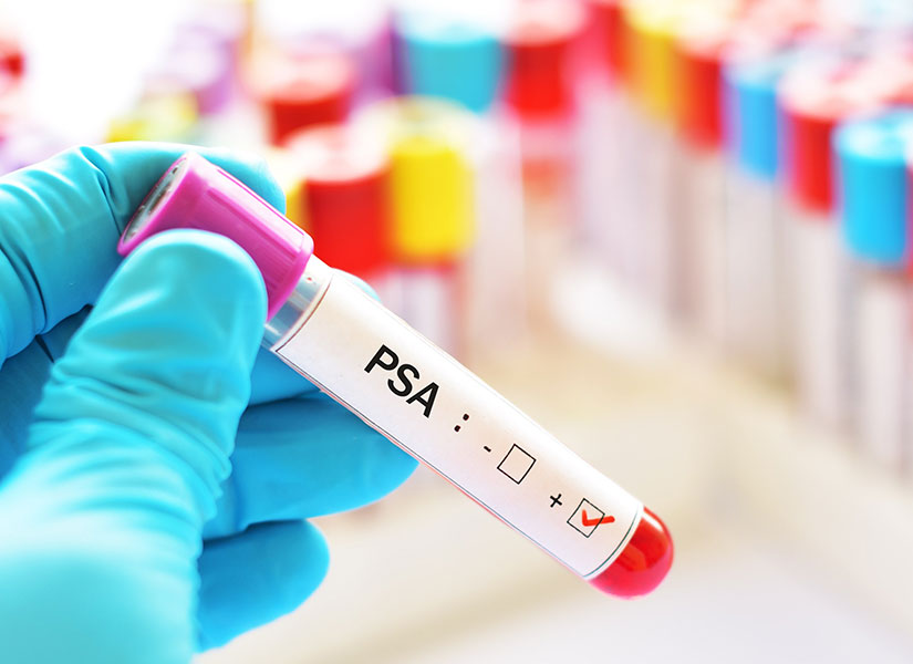 Prostate Specific Antigen 2022 Newsletters Newsletters News