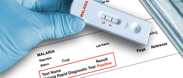 Malaria Test Early