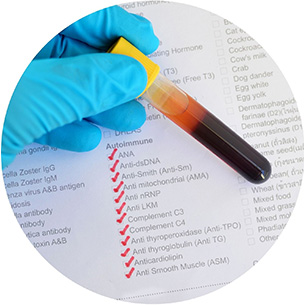Molecular Tests