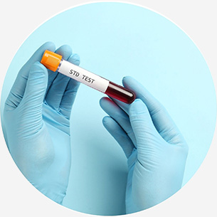 Molecular Tests
